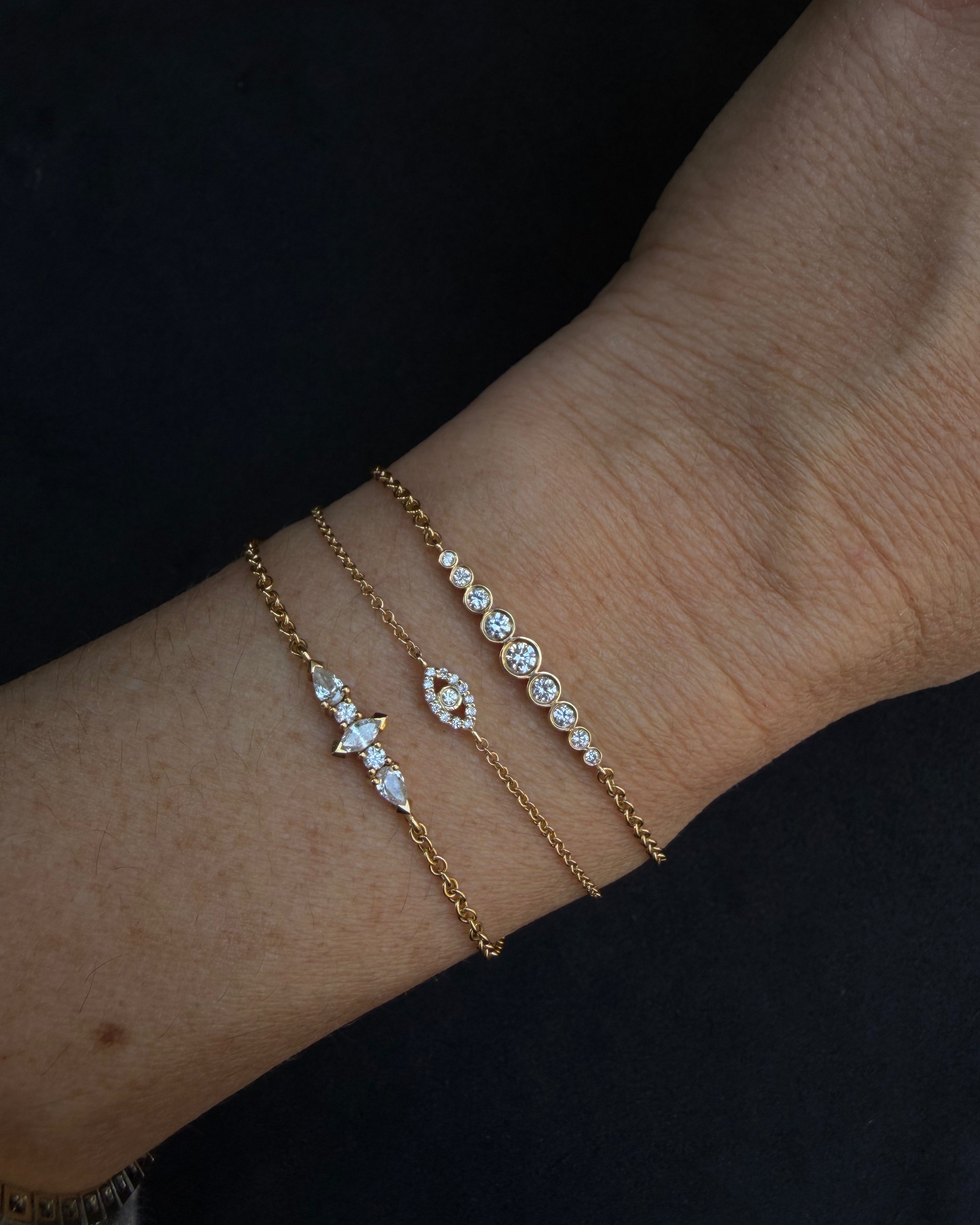 A Wrist Piece Made of Bubbles
